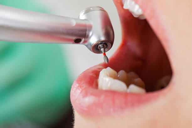 Best Lost Filling or Crown Replacement in Gila Bend, AZ